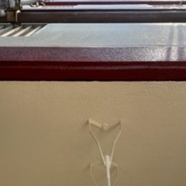 欠損部 復元 アフター