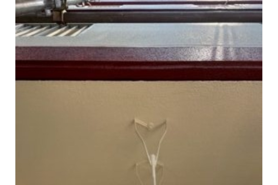 欠損部 復元 アフター